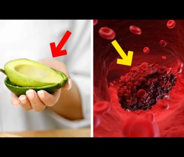 blood clotting