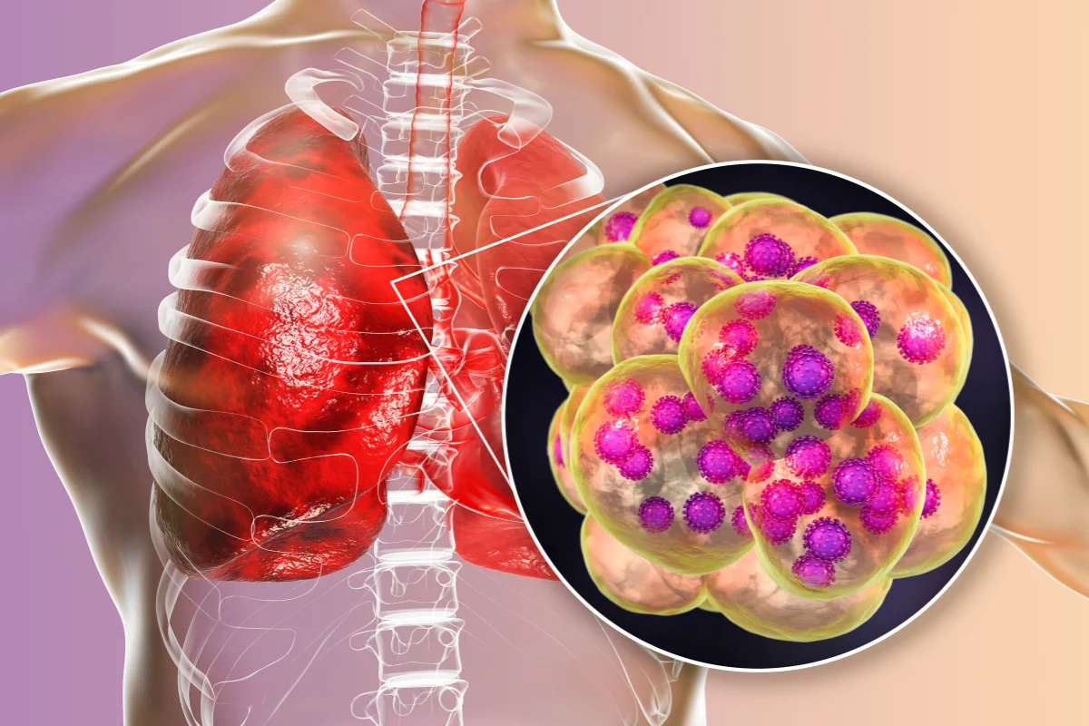 lung health
